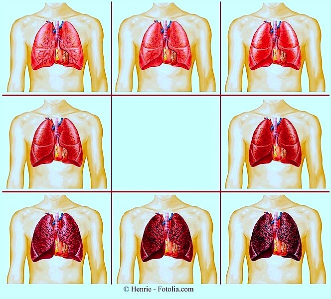 Lungenreinigung: Natürliche Wege zur Entgiftung der Lunge
