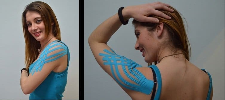 Kinesio taping,schulter