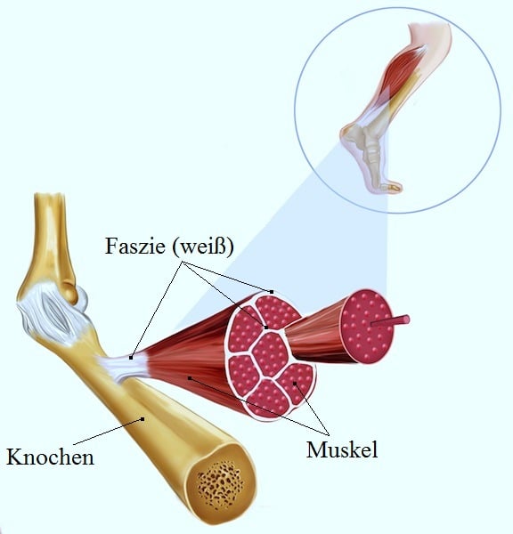 Muskelschmerzen in Bein und Oberschenkel