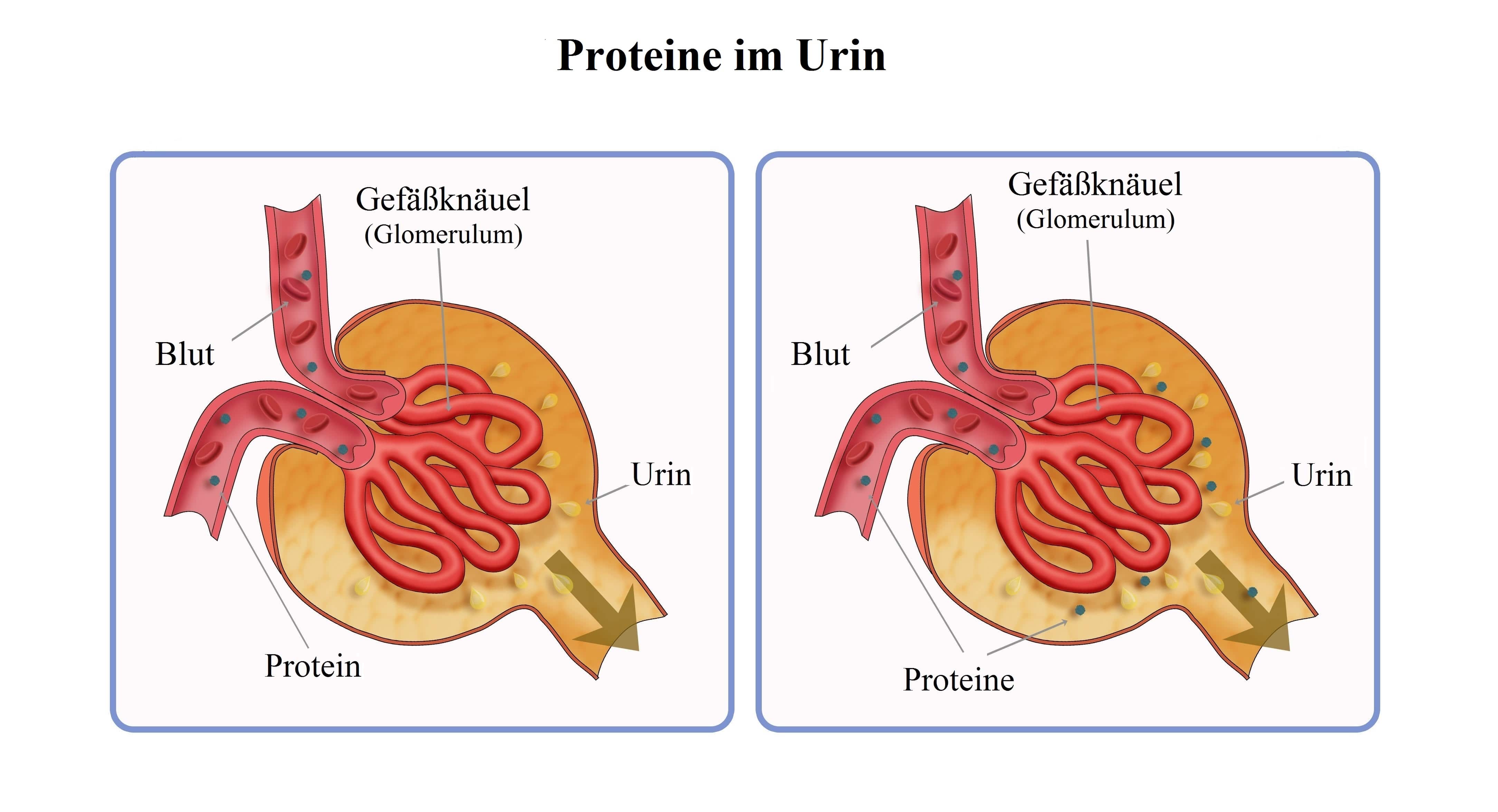 Proteine im Urin