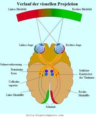 Retinitis pigmentosa,Nerven,Auge,Gehirn