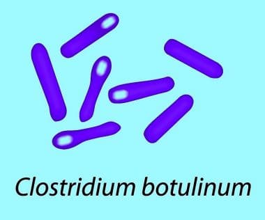Botulinum-und-Botulismus