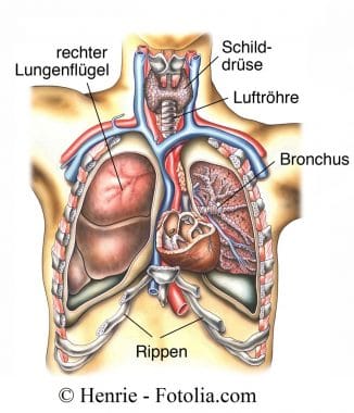 pulmonale-Hypertonie