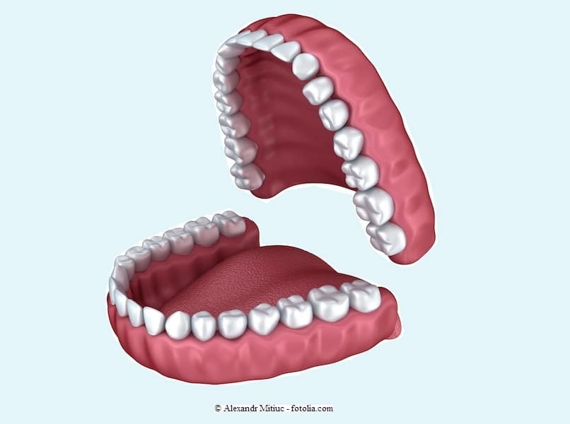 Dentales oder apikales Granulom