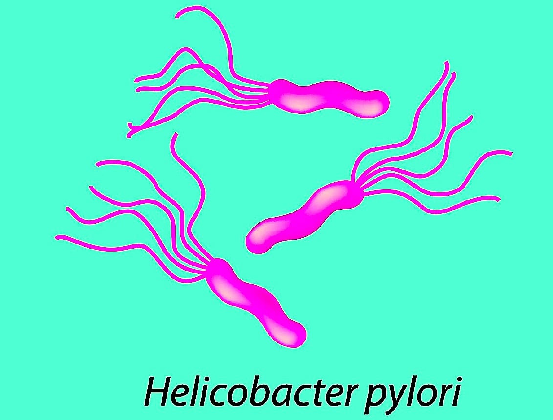 Symptome bei Helicobacter pylori